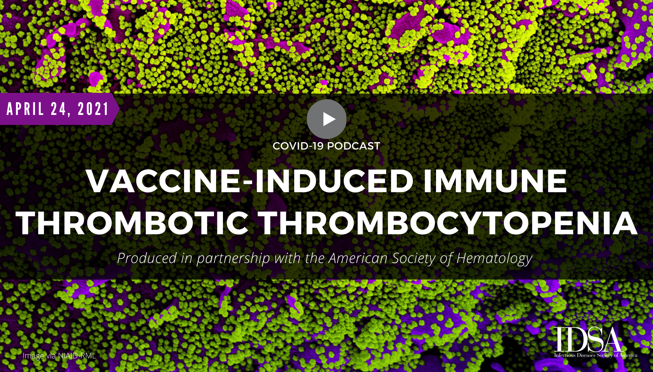 Thrombosis with thrombocytopenia syndrome